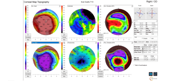 Case Study: When the Answer Isn’t Clear: The Power of Comprehensive Data in Clinical Decision-Making