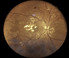 Case Study: Neo or No Neo?