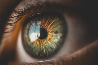 [OCT Observations] Multimodale Bildgebung des trockenen Auges mittels OCT