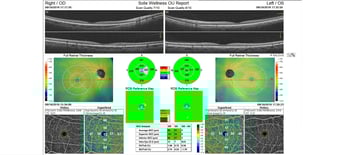 One Platform, More Patients: New OCT Streamlines Exams